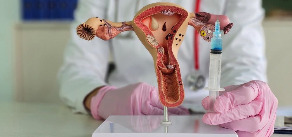 Rejuvenecimiento ovárico: tratamiento que da esperanza a mujeres con infertilidad por la edad