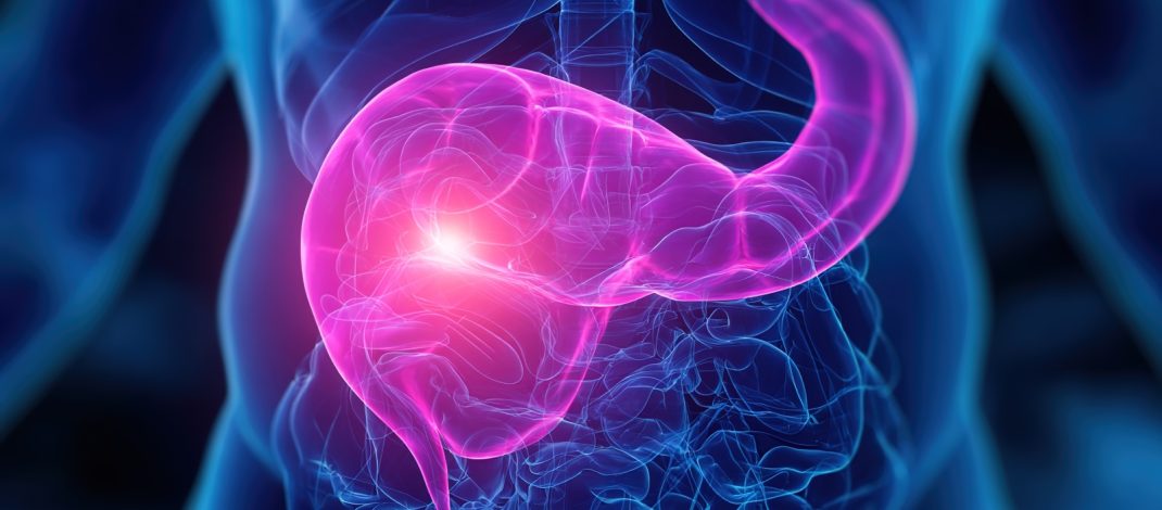 AstraZeneca amplía las alternativas de tratamiento para pacientes con cáncer gástrico