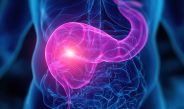 AstraZeneca amplía las alternativas de tratamiento para pacientes con cáncer gástrico